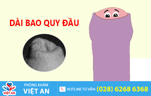 Hình ảnh bao quy đầu dài