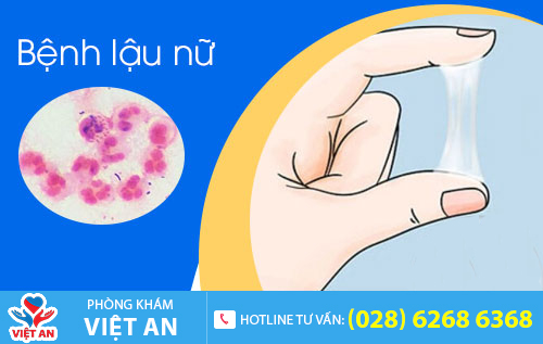 Bệnh lậu khiến chị em đi tiểu ra máu, huyết trắng có mùi khó chịu