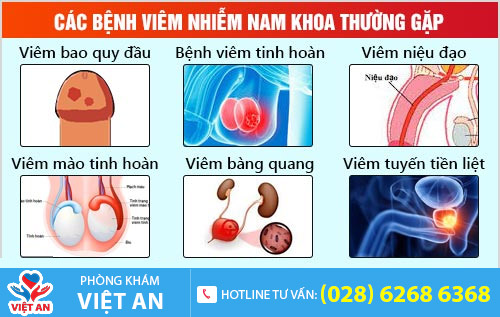 Bệnh viêm nhiễm nam khoa thường gặp