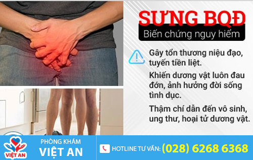 Sưng tấy ở quy đầu dẫn đến nhiều biến chứng nguy hiểm