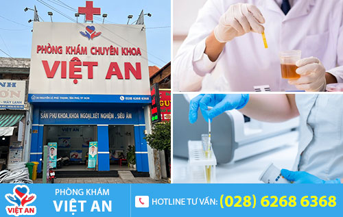 địa chỉ hỗ trợ điều trị bệnh nước tiểu có màu lạ