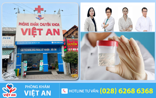 Địa chỉ hỗ trợ tinh trùng đặc, tinh trùng vón cục