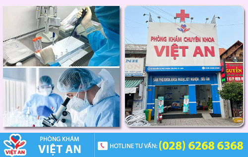 Địa chỉ hỗ trợ điều trị tinh trùng yếu tại TPHCM