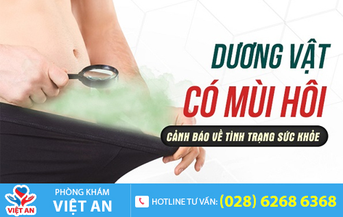 Chảy mủ đầu dương vật, dương vật nặng mùi - Dấu hiệu bệnh lậu