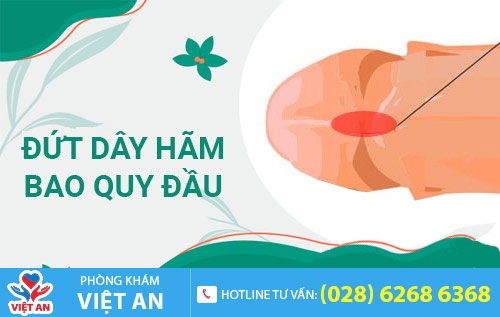 Đứt dây hãm bao quy đầu