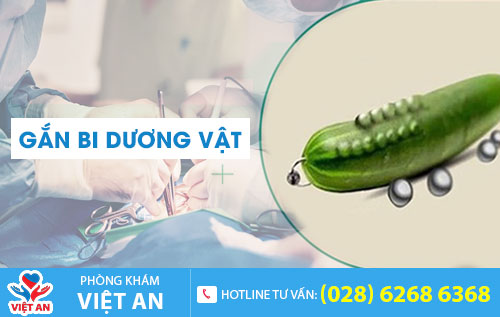 Gắn bi dương vật