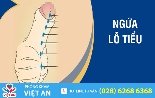 Ngứa lỗ tiểu
