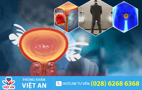Nguy hại của phì đại tuyến tiền liệt