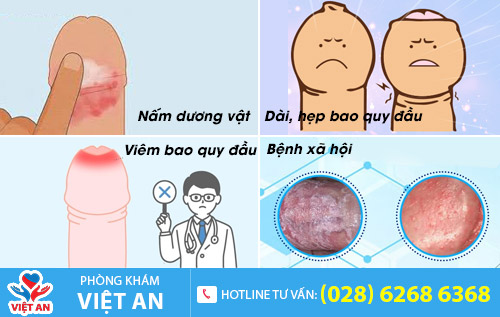 Nguyên nhân gây tróc da dương vật