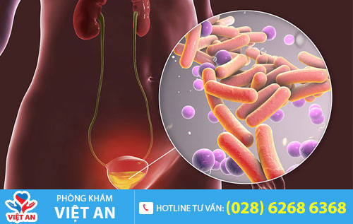 Nguyên nhân gây viêm đường tiểu ở nam giới