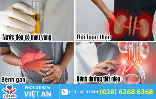 Nguyên nhân nước tiểu có màu vàng