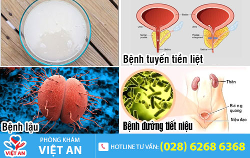 Một số nguyên nhân gây nước tiểu đục