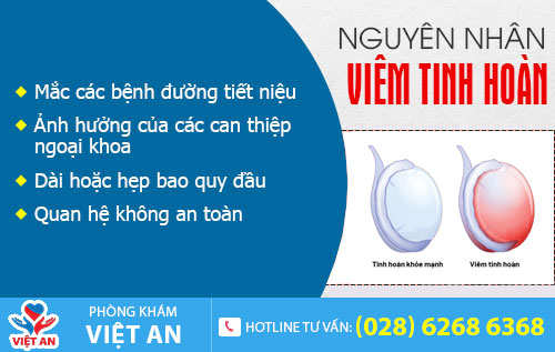 Nguyên nhân gây viêm tinh hoàn