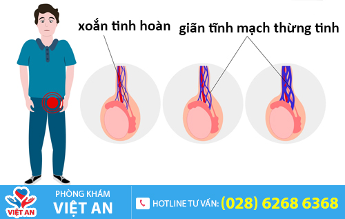Nhóm bệnh tinh hoàn gồm có: xoắn tinh hoàn, giãn tĩnh mạch thừng tinh,...
