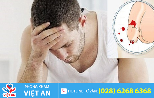 Rách dương vật có thể do nhiều nguyên nhân