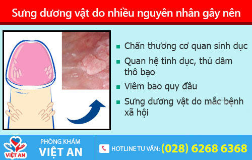 Sưng dương vật do nhiều nguyên nhân gây nên