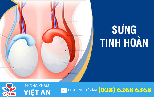 Sưng tinh hoàn là dấu hiệu bệnh gì?