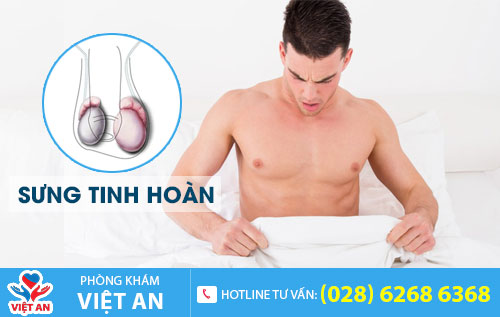 Sưng tinh hoàn