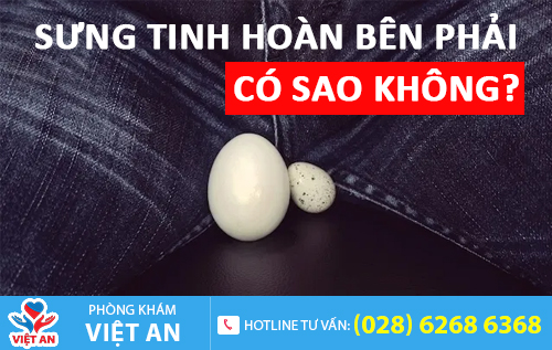 Sưng tinh hoàn bên phải cảnh báo nam giới nhiều bệnh nam khoa nguy hiểm