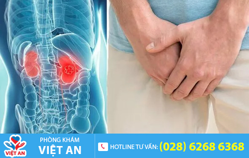 Sưng tinh hoàn một bên là dấu hiệu nhiều bệnh nguy hiểm
