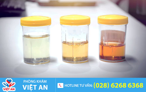 Tiểu ra máu