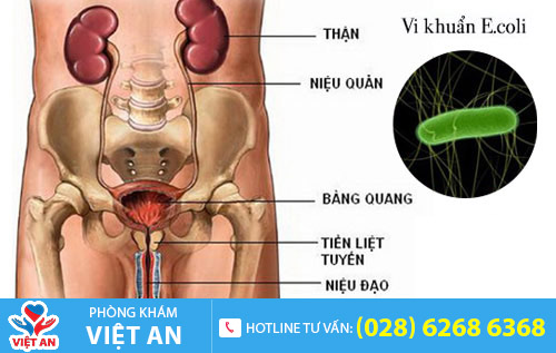 Các bệnh về đường tiết niệu, tuyến tiền liệt và niệu đạo có thể gây tiểu ra máu