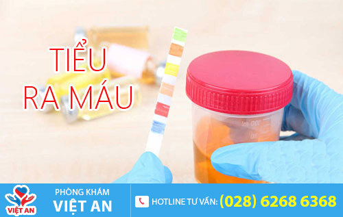 Tiểu ra máu khiến chị em thường xuyên bất an, lo lắng