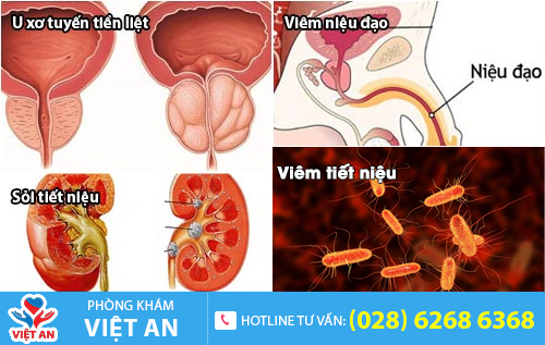 Các nguyên nhân dẫn đến tình trạng tiểu ra máu ở nam