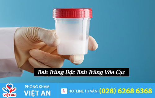 Tinh trùng đặc, tinh trùng vón cục