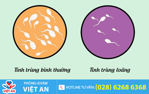 Tinh trùng loãng