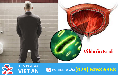 Viêm đường tiết niệu do vi khuẩn E.coli gây ra