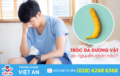 Tróc da dương vật