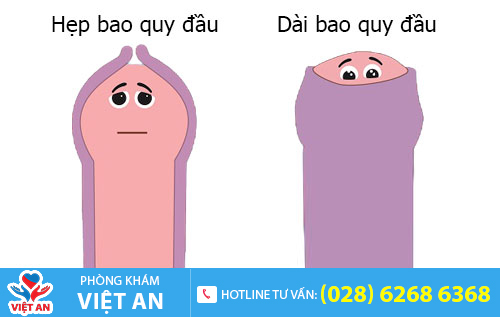 Phân biệt dài/hẹp bao quy đầu
