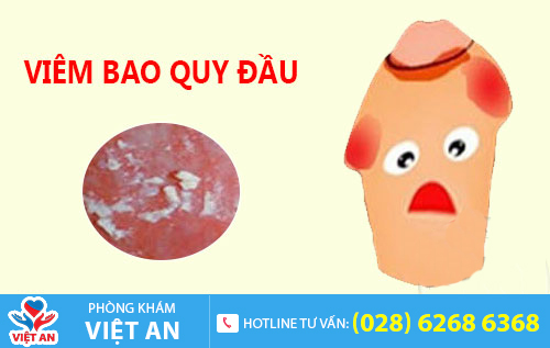 Viêm bao quy đầu làm xuất hiện các bợn trắng