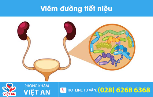 Viêm đường tiết niệu