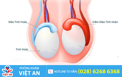 Viêm mào tinh hoàn