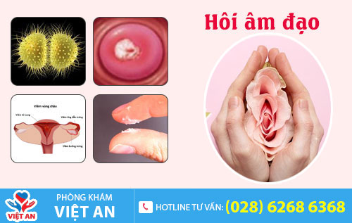 Hôi âm đạo