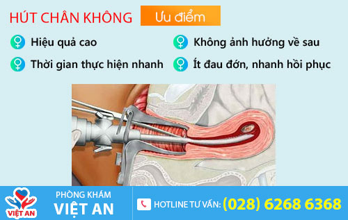Hút thai chân không