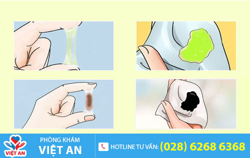 Huyết trắng có màu