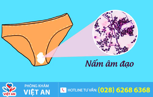Nấm âm đạo