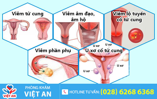Nguyên nhân huyết trắng có màu