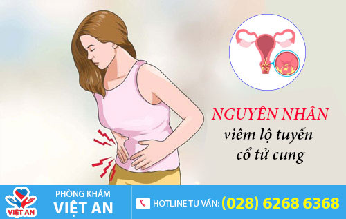 Nguyên nhân viêm lộ tuyến cổ tử cung