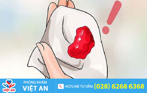 Quan hệ ra máu