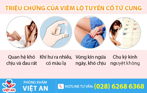Triệu chứng viêm lộ tuyến cổ tử cung