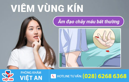 Viêm vùng kín