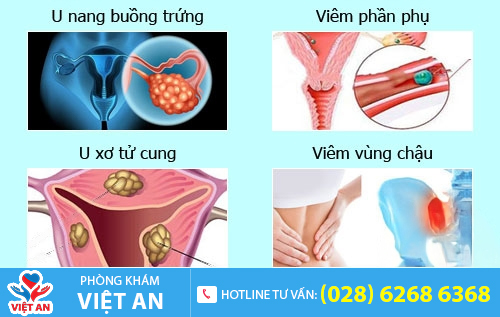 Biểu hiện viêm vùng chậu, viêm phần phụ, u xơ tử cung, u nang buồng trứng