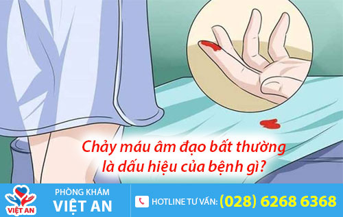 Chảy máu âm đạo bất thường