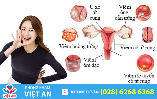 Bệnh phụ khoa gây nhiều ảnh hưởng đến đời sống chị em