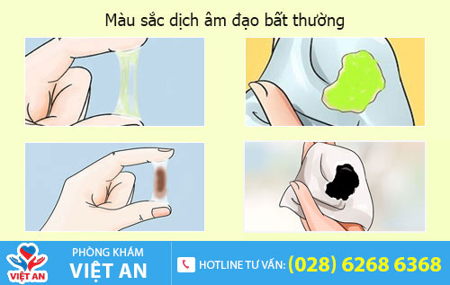Dịch âm đạo