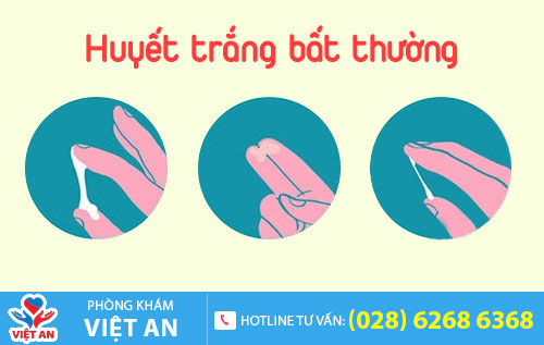 Huyết trắng bất thường